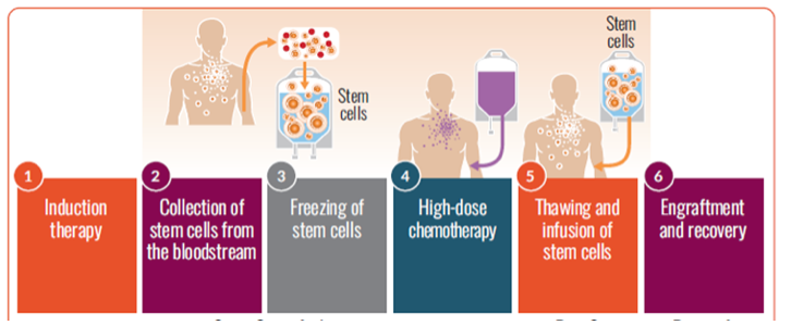 Autologous stem cell transplantation steps: 1. induction therapy, 2. collection of stem cells from the bloodstream, 3. freezing of stem cells, 4. high-dose chemotherapy, 5. thawing and infusion of stem cells, 6. engraftment and recovery.
